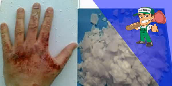 Perigos da soda cáustica: queimadura química e reação violenta